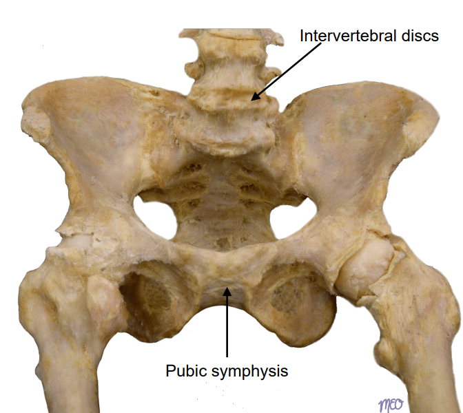 <p><strong><u>Midline</u></strong> joint where bones are connected by <strong><u>fibrocartilage</u></strong> such as the <strong>pubic symphysis</strong> or <strong>intervertebral discs</strong></p>
