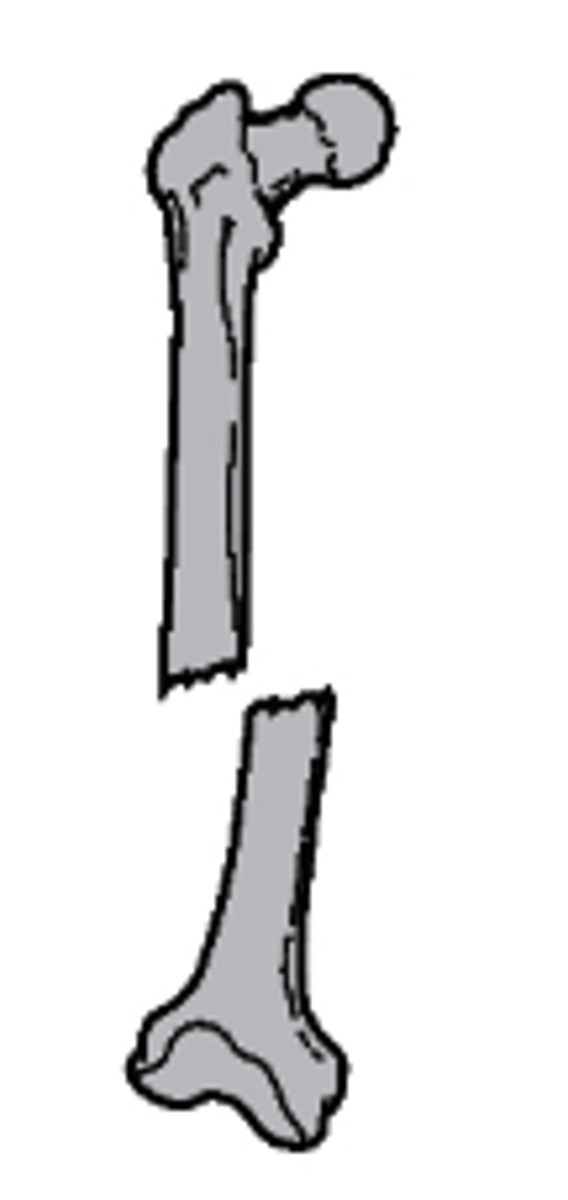 <p>what type of alignment is seen with this fracture?</p><p>a. nondisplaced</p><p>b. medial displacement</p><p>c. lateral displacement</p><p>d. distracted</p>