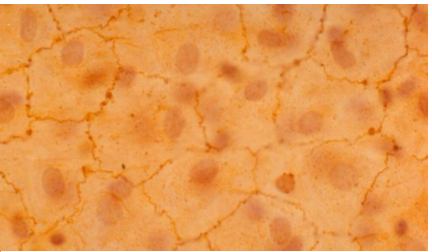 <p>What is simple squamous epithelial</p>