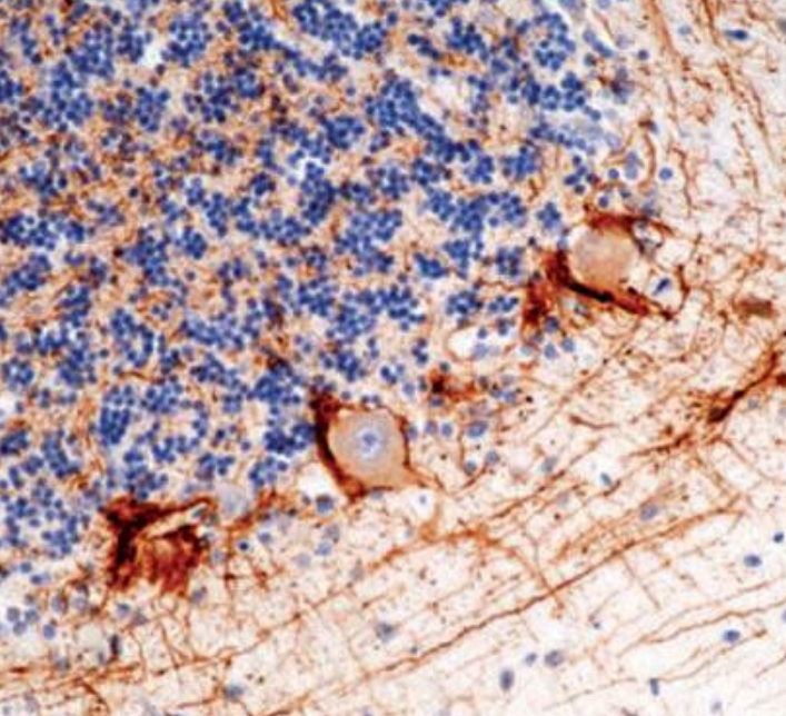 <p>IHC stain for neurons, neuronal processes and peripheral nerves</p>