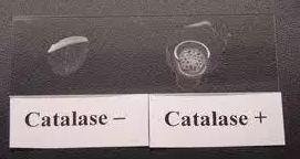 <p><mark data-color="yellow">Chemical reactions - catalase</mark></p><p>Can you label, describe and explain what this diagram is/shows?</p>