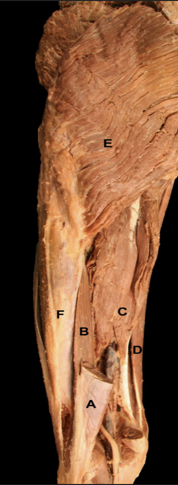 <p>Identify the muscles of the<strong> Posterior Thigh</strong></p>
