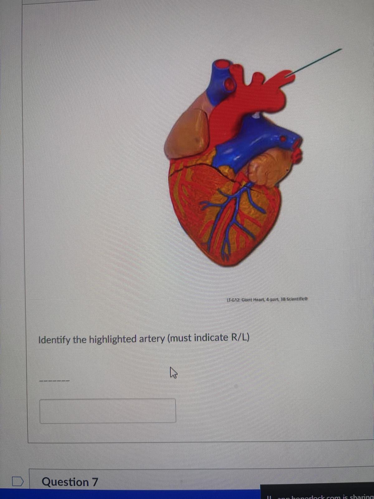 <p>Identify the highlighted artery (must indicate R/L)</p>