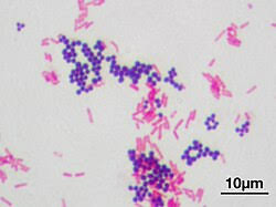 <p>Stain that determines whether or not a cell has peptidoglycan in the cell wall (gram negative vs positive), is a positively charged, differential stain</p>