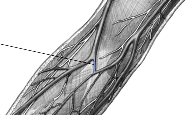 <p>Which veins:</p><ul><li><p>On anterior elbow</p></li><li><p>Connects cephalic and basilic vein</p></li></ul><p></p>
