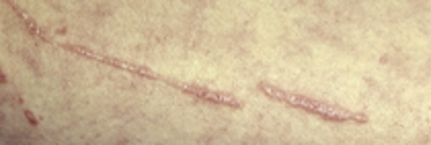 <p>= fenomeen waarbij het letsel zich uitbreidt naar een plaats waar de huid een trauma heeft ondergaan (barrière doorboord) + 'opengekrabt' letsel</p>