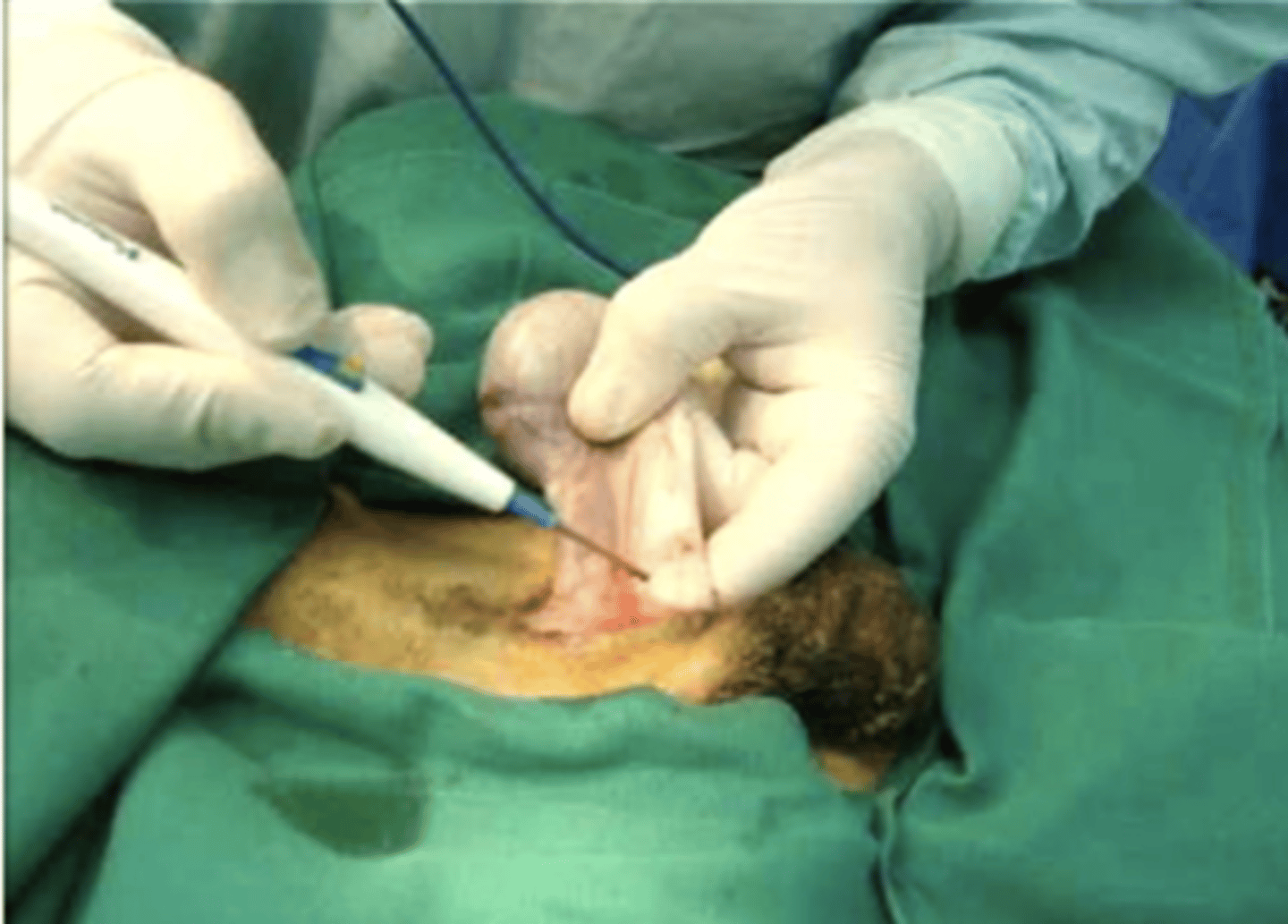 <p>what is the name for this operation?</p>