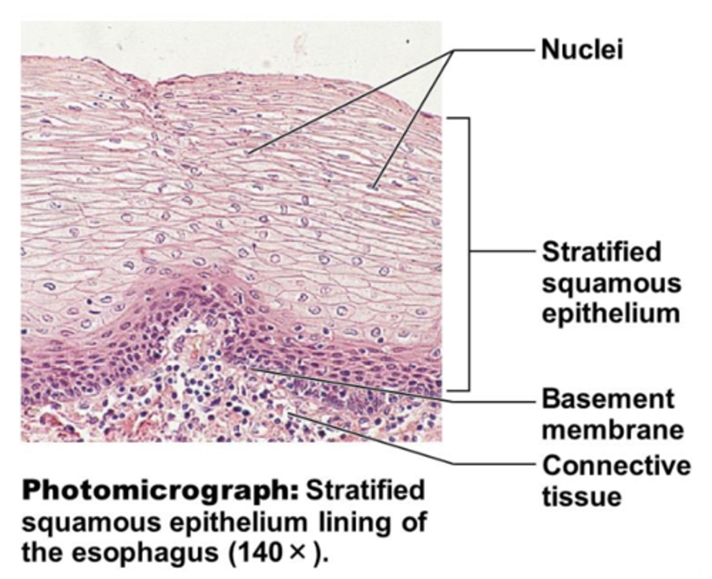 <p>- named for cells present at the free (apical) surface, which are squamous</p>