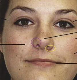 <p>What are the circles</p>