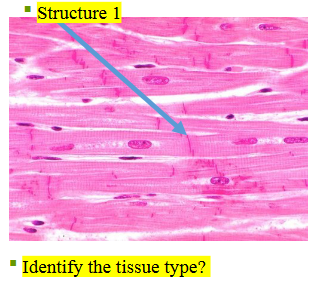 <p>What type of tissue is this?</p>