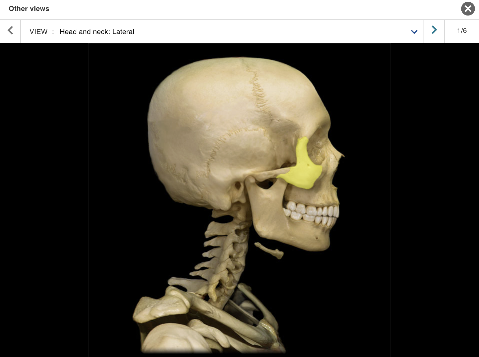 <p>Location:</p><p class="p1">• Skull (anterior and lateral)</p><p class="p1">Description:</p><ul><li><p>﻿﻿Paired, irregular-shaped bone</p></li><li><p>﻿﻿Temporal process contributes to zvaomatic arch</p></li></ul><p class="p1">Also known as:</p><p class="p1">• "Cheekbone"</p><p class="p1">Comment:</p><p class="p1">• Forms part of floor and lateral wall of orbit</p>