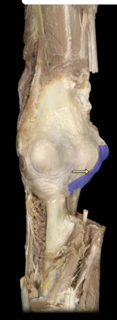 <p>what ligament is this?</p>