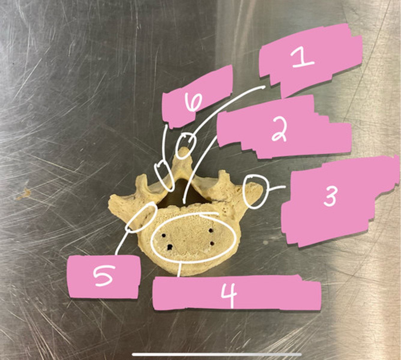 <p>What is #6?</p>