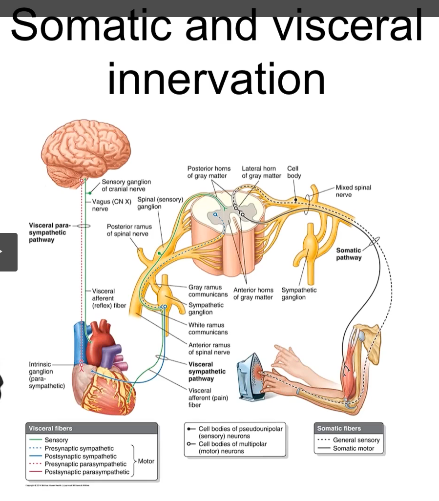 <p>this is an example of the somatic nervous system</p><ol><li><p>we touch a <strong>hot iron</strong></p></li><li><p><strong>sensory receptors</strong> in your <strong>skin </strong>are going to be activated </p></li><li><p>sensory receptors use the <strong>general sensory afferent fiber (GSA, </strong>pseudounipolar, the cell body of the neuron is located in the dorsal root ganglion, a ganglion is a collection of neurons outside the CNS<strong>) </strong>to the <strong>posterior or dorsal rami </strong>to</p></li><li><p>the axon of the pseudouniopolar neuron is going to enter the spinal cord via the posterior rootlets. </p></li><li><p>once the axon enters the grey matter, it’s then going to make a synapse on an interneuron. </p></li><li><p>this is gonna synapse on another neuron which is going to synapse in another neuron which is located in the anterior or ventral portion of the gray matter of the spinal cord. </p></li><li><p>this neuron that is located in the anterior portion of the spinal cord, specifically the anterior horn, is going to be called a motor neuron, this motor, or efferent neuron, is going to have an axon that exits the spinal cord via the anterior rootlets</p></li><li><p>the anterior rootlets are going to form the anterior roots and exit the spinal cord through the anterior rami. </p></li><li><p>the anterior rami is going to eventually reach the muscle that’s going to remove the hand from the source of the heat</p></li></ol><p></p>