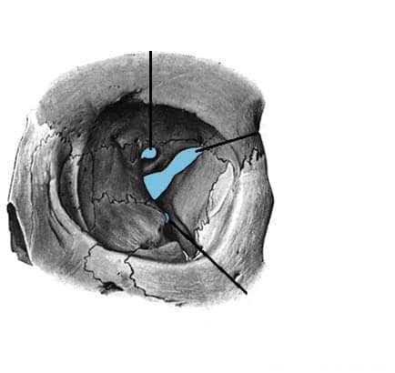 <p><span>Fibers blend at lateral side of orbit</span></p>