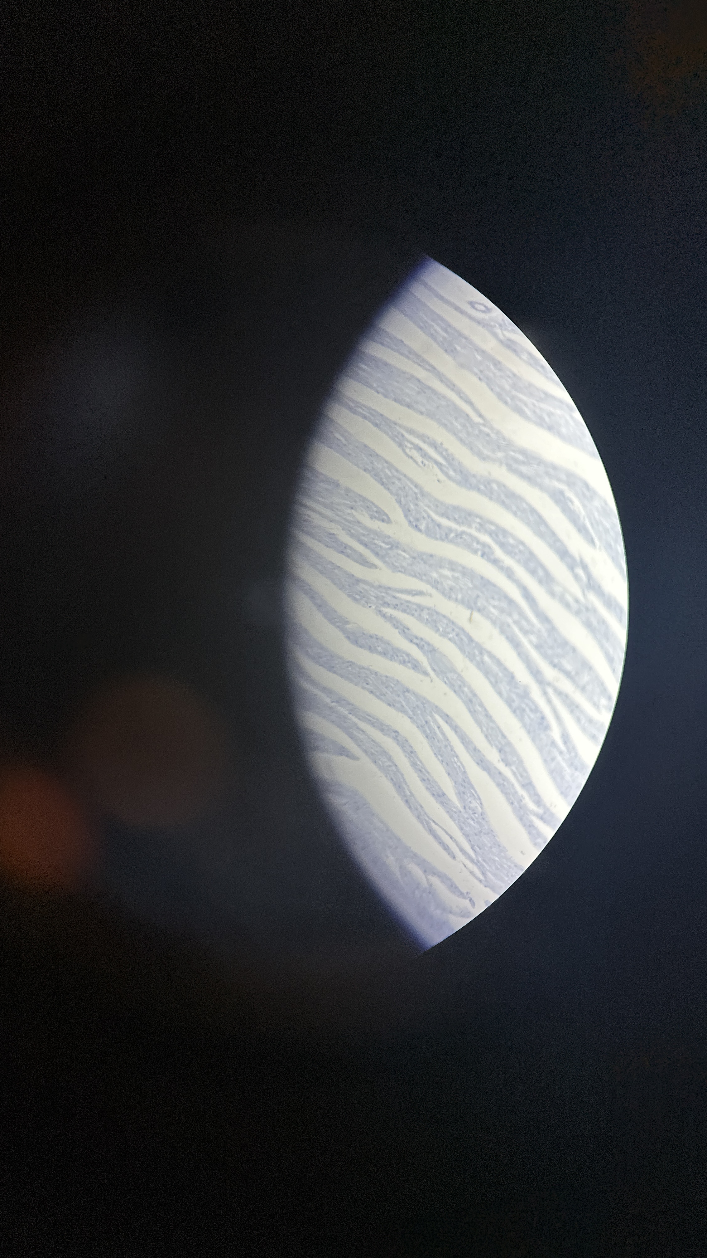 <p>What is the magnification level of the Cardiac Muscle?</p>