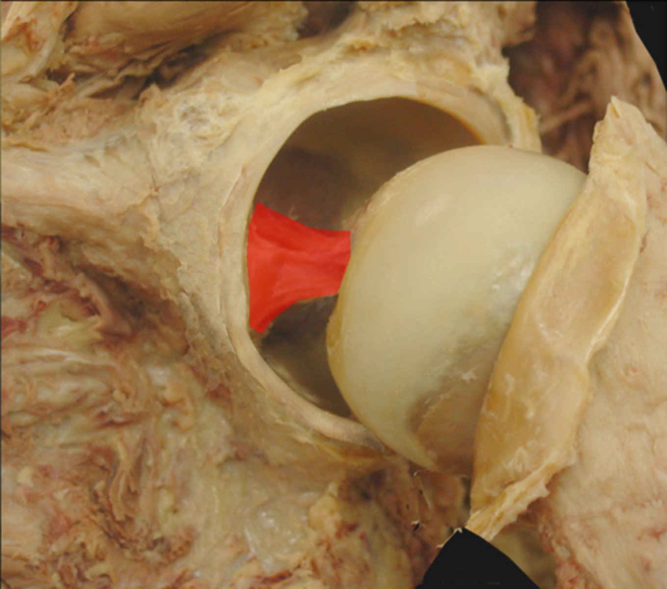 <p>connects head of femur to acetabulum</p>