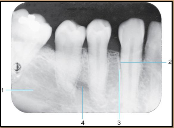 <p>Label the landmarks 1-4 of the Mandibular Premolar Area</p>