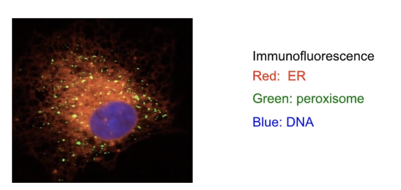 <ul><li><p>ER is a <strong>dynamic organelle</strong>.</p></li><li><p>Undergoes constant <strong>fission and fusion</strong>.</p></li><li><p><strong>Changes shape and structure</strong>.</p></li><li><p><strong>Migrates</strong> to new locations within the cell.</p></li><li><p>Can be visualized using <strong>fluorescent labeling</strong>:</p><ul><li><p><strong>DNA (blue)</strong></p></li><li><p><strong>Peroxisomes (green)</strong></p></li><li><p><strong>ER (red)</strong></p></li></ul></li></ul><p></p>