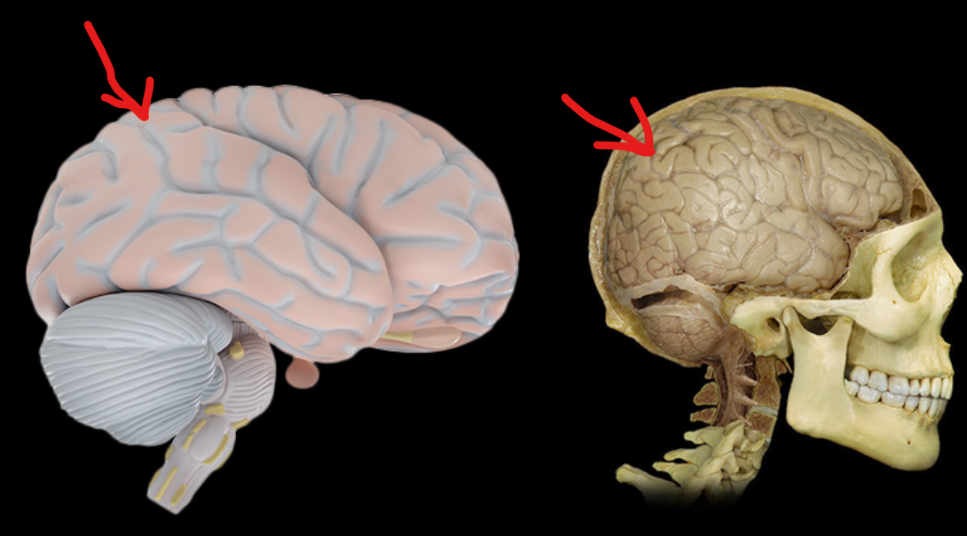 <p>What Lobe is this?</p>