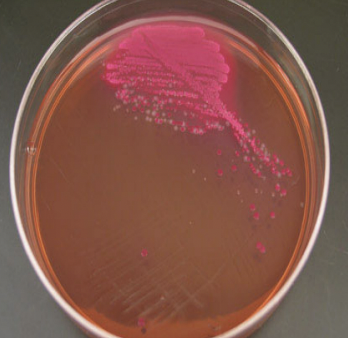 <p>Classification: Differential</p><p>Ingredients: Crystal violet, Salt, Lactose, pH indicator</p><p>Lab Usage: Differs gram negative and gram positive bacteria</p><p>Results: red/pink - ferments lactose</p>