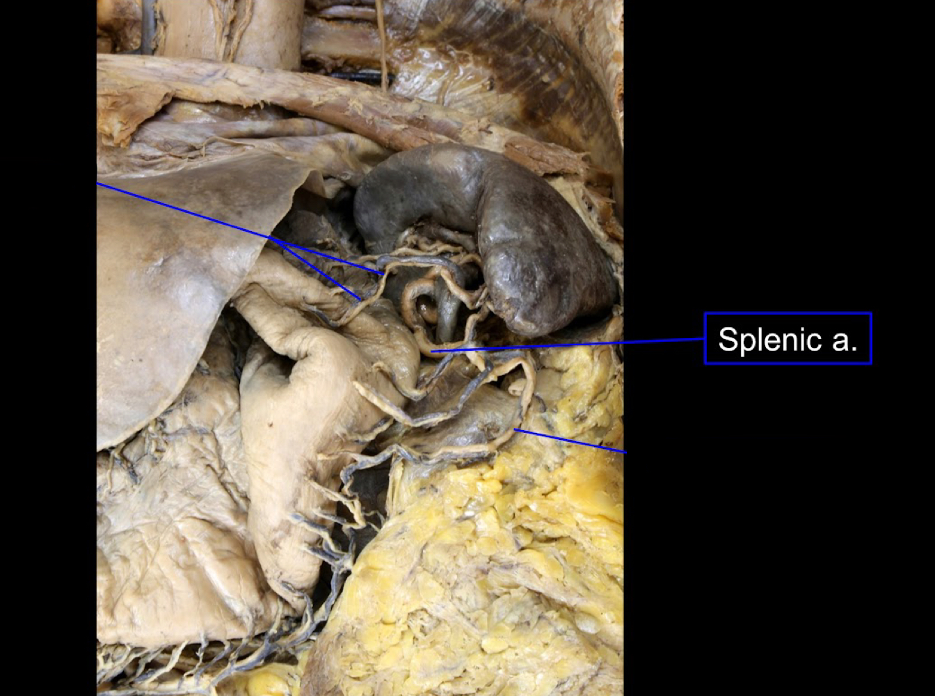 <p>what are the 3 branches of the splenic artery?</p>