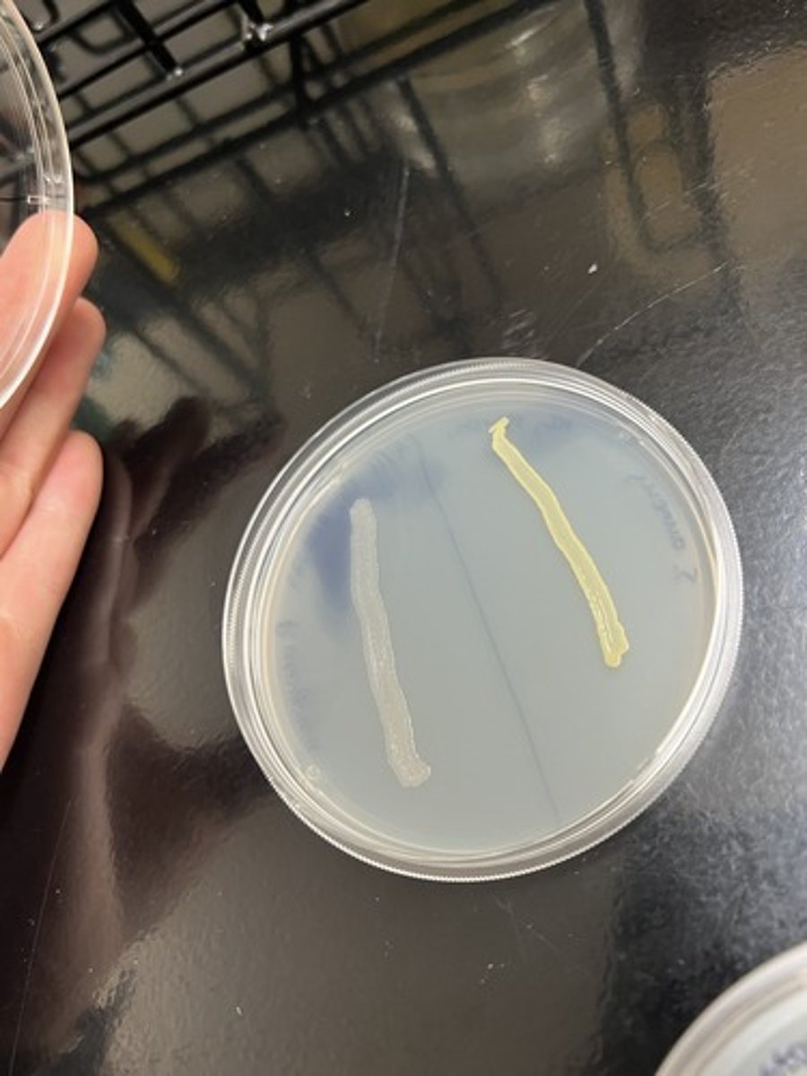 <p><strong>Differentiates </strong>organisms based on the ability to produce the DNase enzyme.</p><p>Ability to produce DNase (+) - Clearing around organism</p>