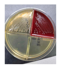 <p>lets say you subcultured from you respiratory plate onto a quad plate and saw this, what is most likely the organism </p>