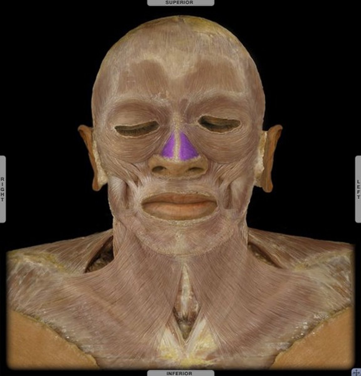 <p>elevates corners of nostrils</p><p>flares the nostrils</p>