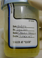 <p>What method of COLLECTION &amp; TRANSPORT OF URINE is this?</p>