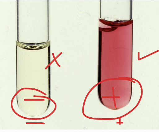 <p>VP A-H Reaction </p>