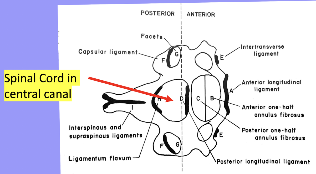 <p>Spinal Cord in Central Canal</p>