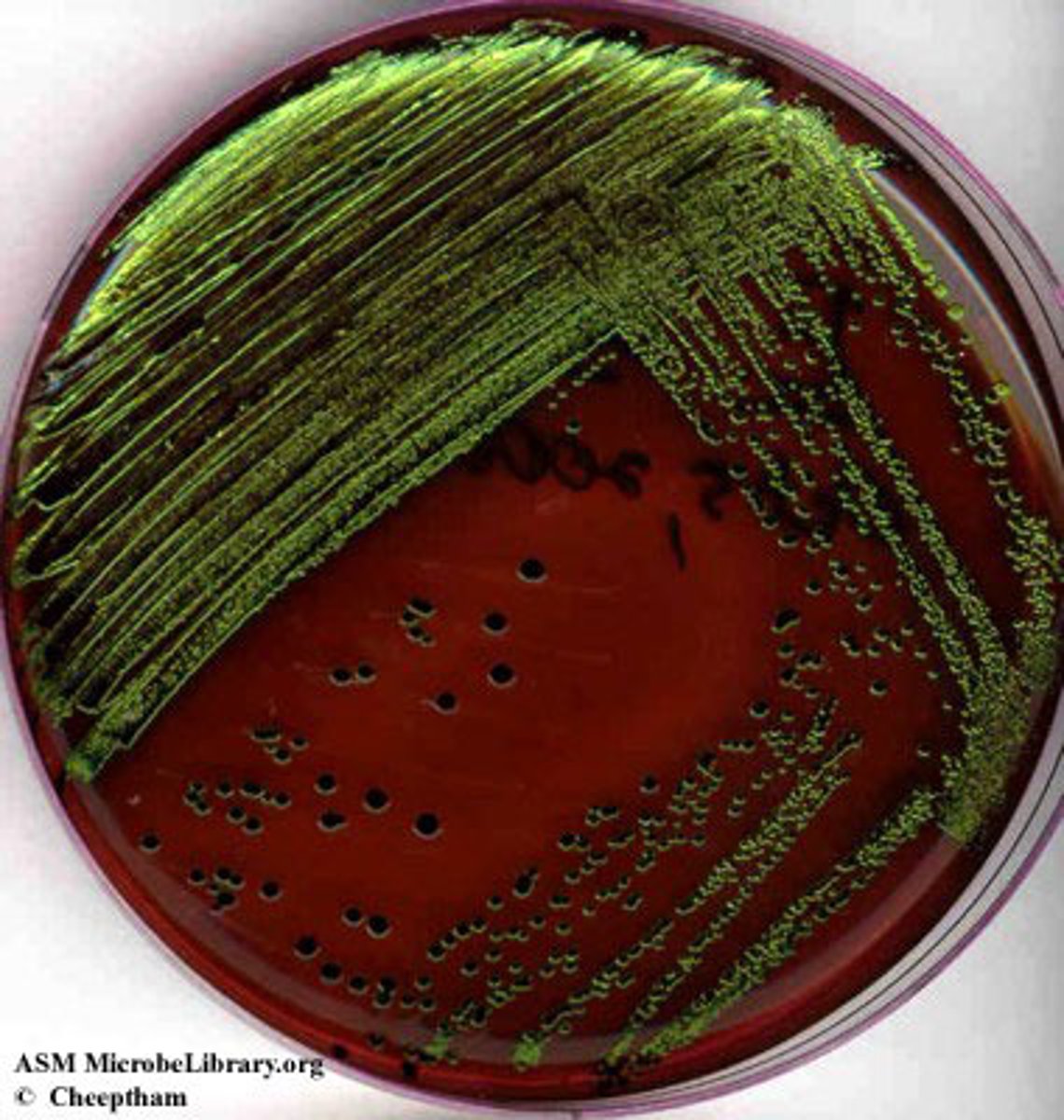 <p>They are E.coli that grow on EMB, ferment lactose or sucrose, producing lot of acid quickly.</p><p>Bacteria colonies appear blue black w/ metallic green sheen</p>