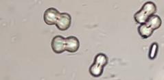 <p>What type of alkaline urine crystal is this?</p>