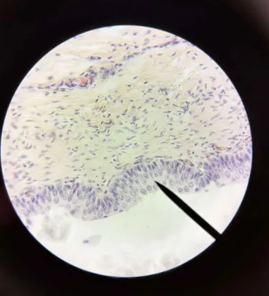 <p>What tissue type is this?</p>