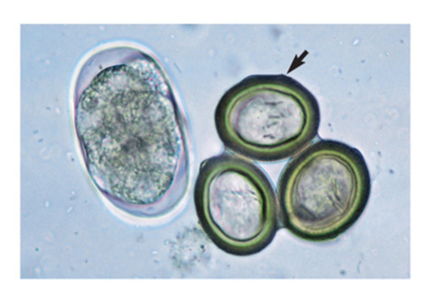 <p>When you find these ova on a fecal float, you ID them as</p>
