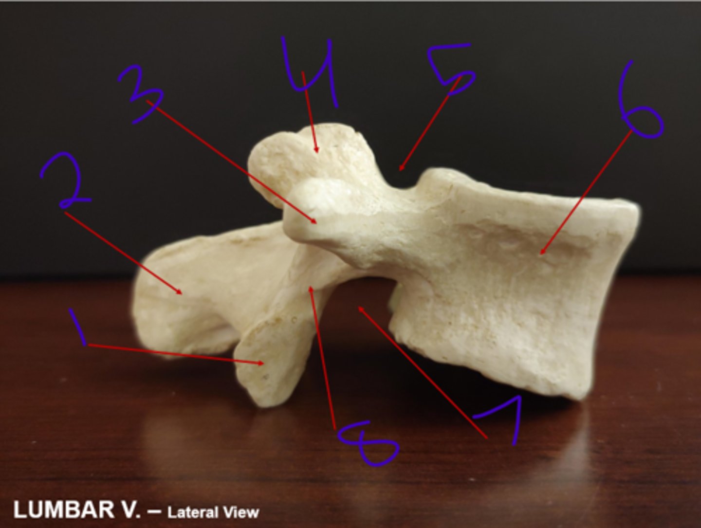 <p>Lumbar Lateral - #4</p>
