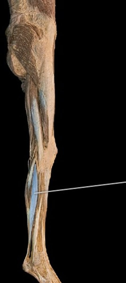 <p>What muscle is this?</p>