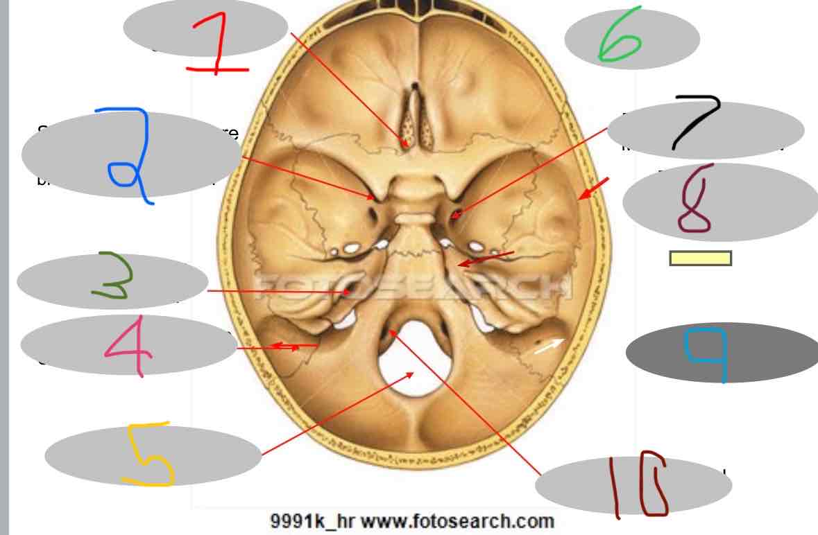 <p>What does #2 depict?</p>