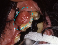 <ul><li><p>Acanthomatous ameloblastoma</p></li><li><p><span style="color: red"><strong>MOA: </strong></span>Fibromatous, ossifying, giant cell, acanthomatous</p><ul><li><p>Arise from <strong>periodontal lig</strong></p></li><li><p><strong>benign</strong></p></li></ul></li><li><p><span style="color: red"><strong>CS: </strong></span><strong>gingival proliferation</strong></p></li><li><p><span style="color: red"><strong>TX:</strong></span> Wide <strong>SX </strong>excision (tooth + bone), radiation</p></li></ul><p></p>