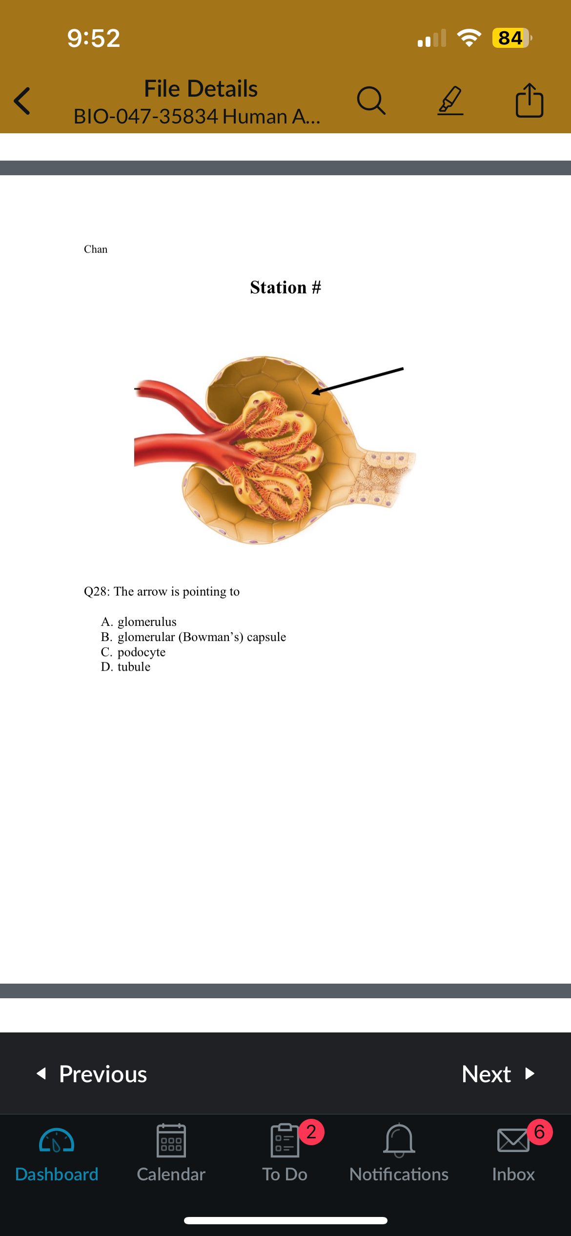 <p>Q28: The arrow is pointing to</p>
