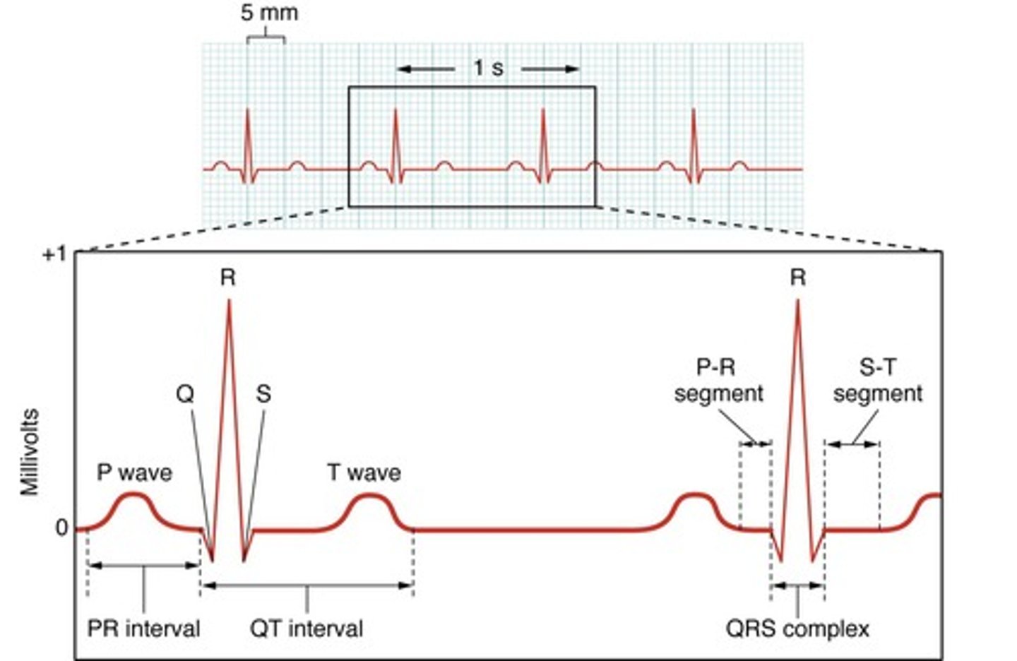 <p>record of the electrical activity of the heart</p>