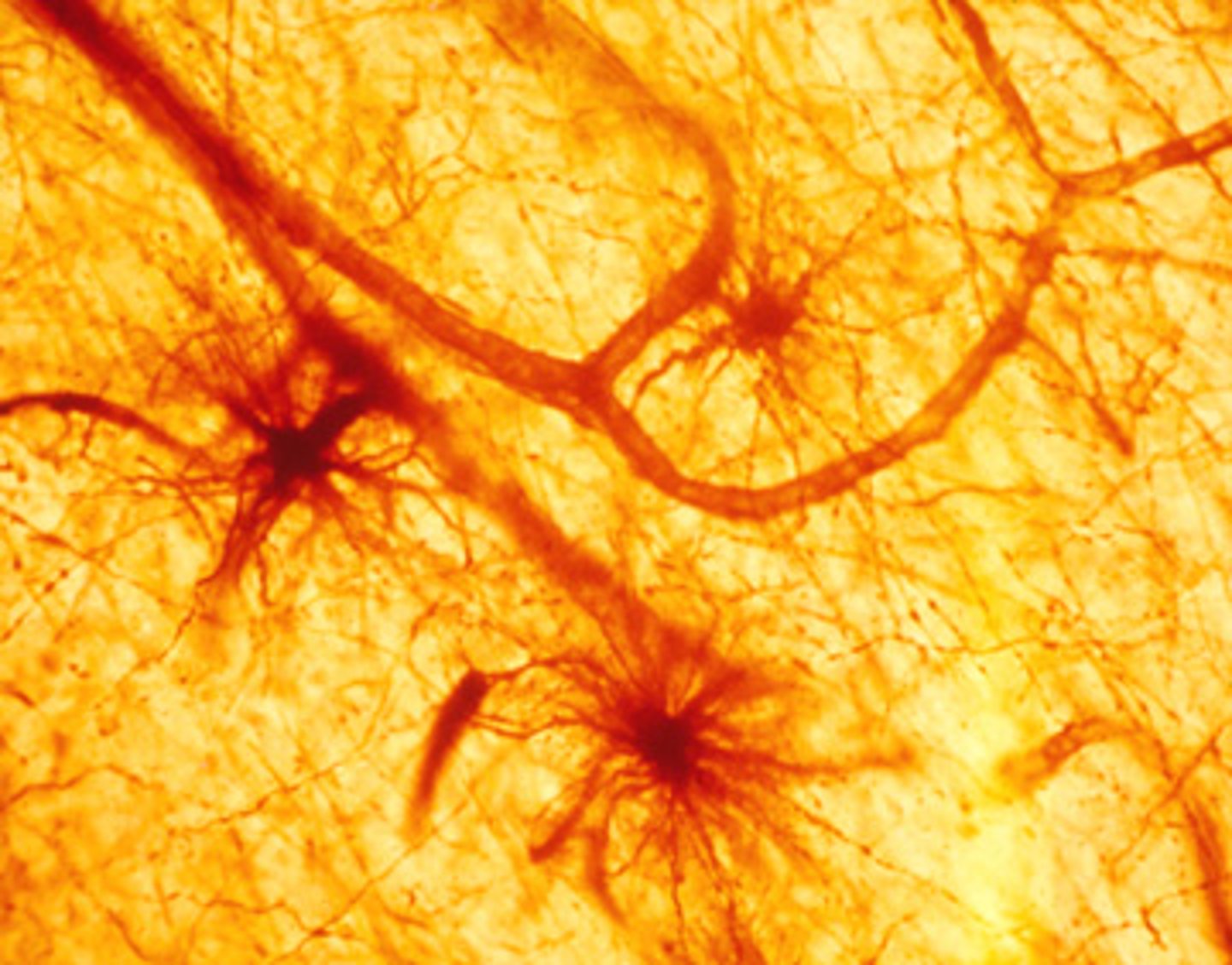 <p>What are neurofilament proteins?</p>