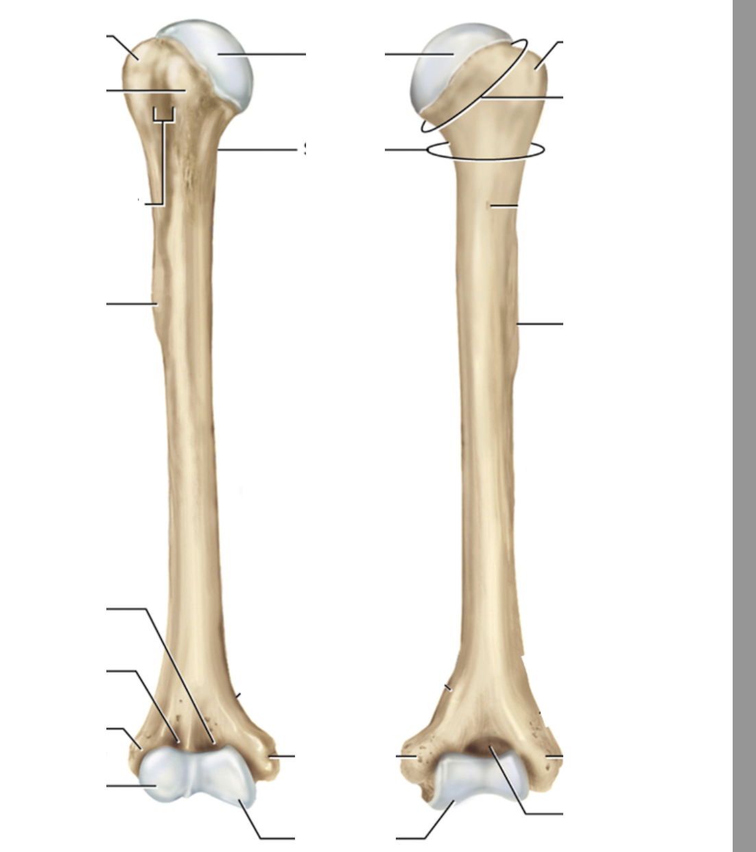 <p>Identify the bone features of the humerus&nbsp;</p>