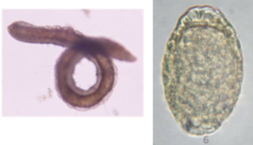 <p>Which parasite is depicted in the image?</p>