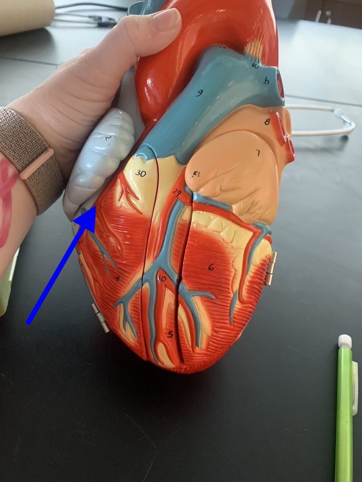 Name the heart structure.