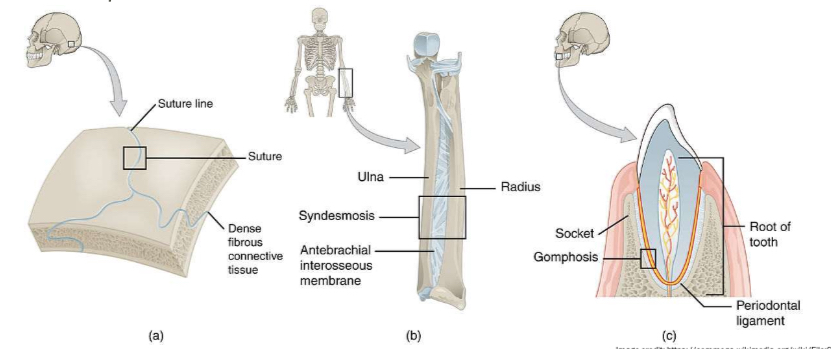 <p>Non-mobile: sutures, syndesmosis, gomphosis</p>