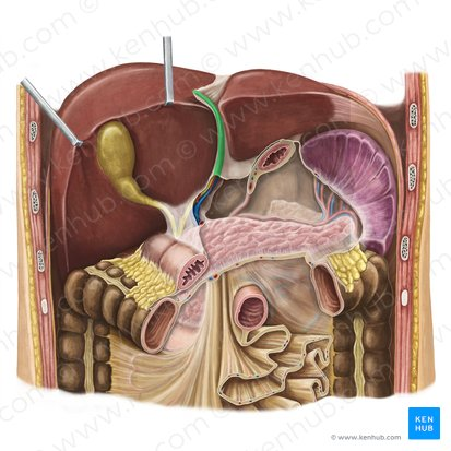 <p>What ligament is shown?</p>