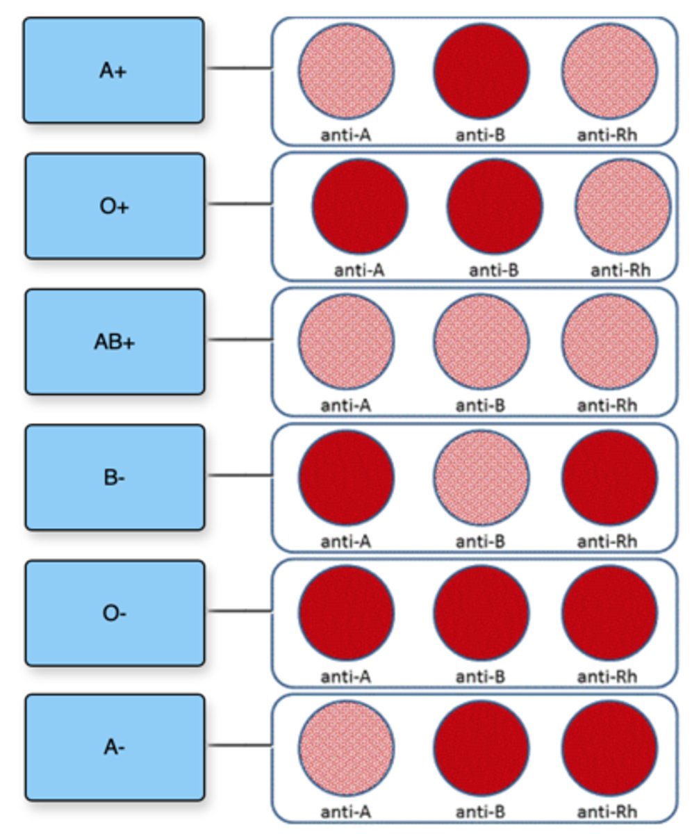 <p>A, B, Rh</p>