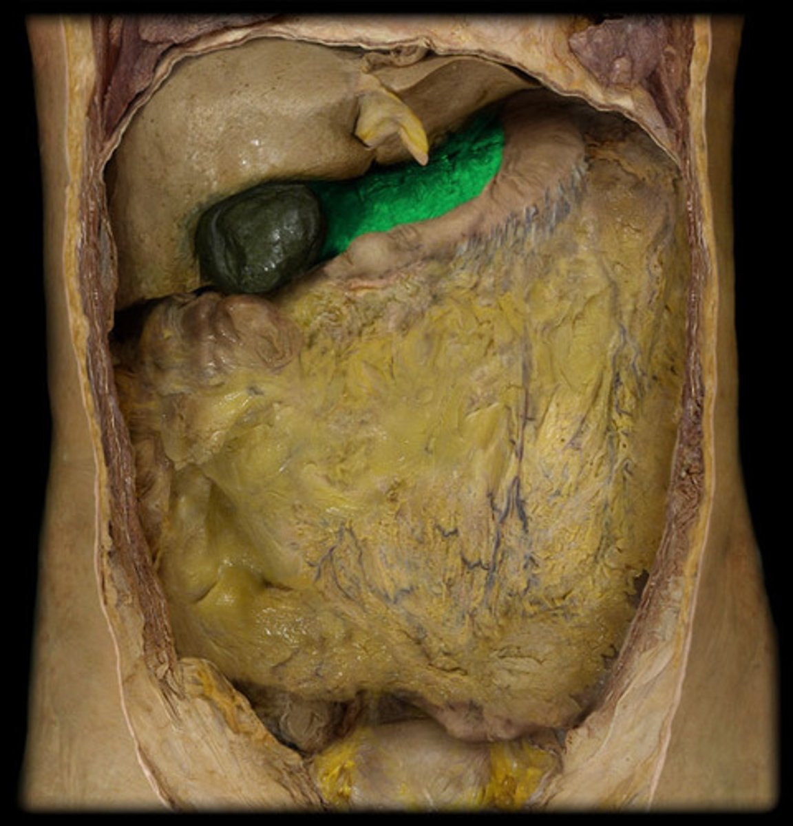 <p>What is this?</p>